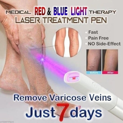 Medifwd Blue Light Therapy Varicose