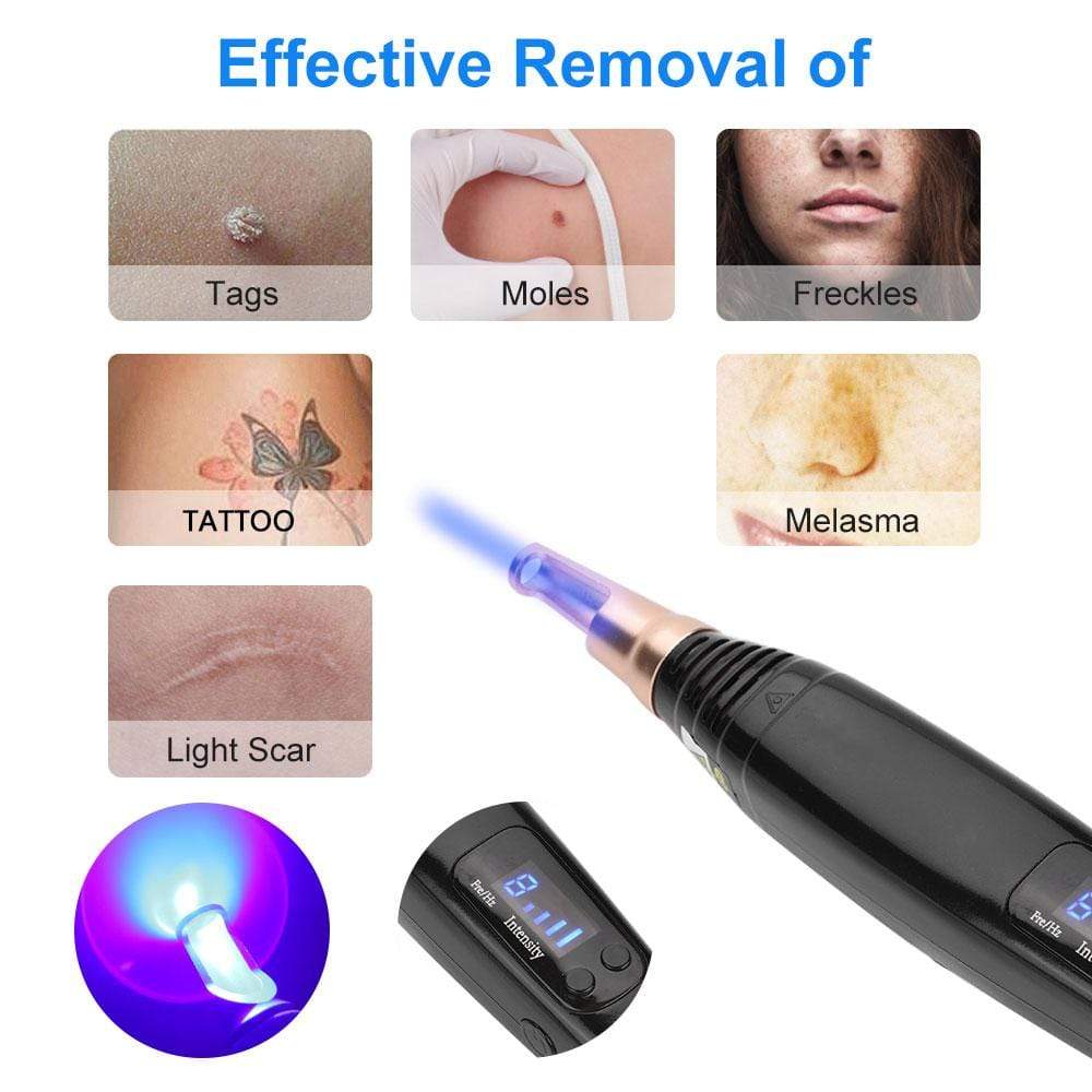 Portable Home Picosecond Laser TattooRemoval Pen For Dark Spot Mole Acne  Scar  eBay