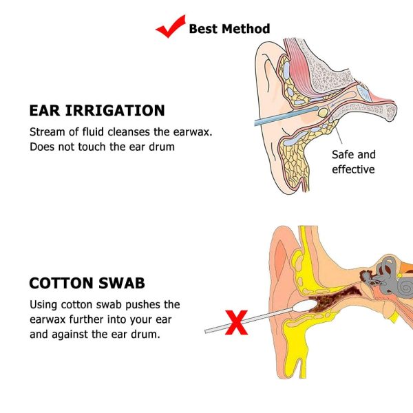 Professional Ear Irrigator For Wax Removal Ear Cleaning Kit