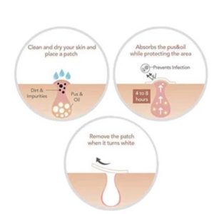 Skin Tag & Acne Patch ( 24 Pcs )