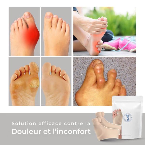 Bunioncare Orthopedic Hallux Valgus Corrector