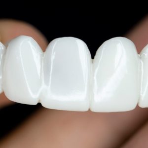 100 Adjustable Whitening Invisible Holeless Braces