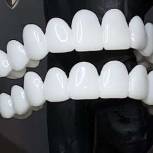 100 Adjustable Whitening Invisible Holeless Braces