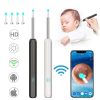 Clean Earwax Wi Fi Visible Wax Elimination Spoon,Usb 1080P Hd Load Otoscope