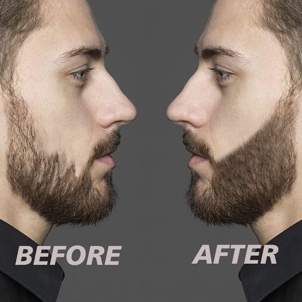 Beardfiller Set - Tighter And Fuller Beard For All Men!